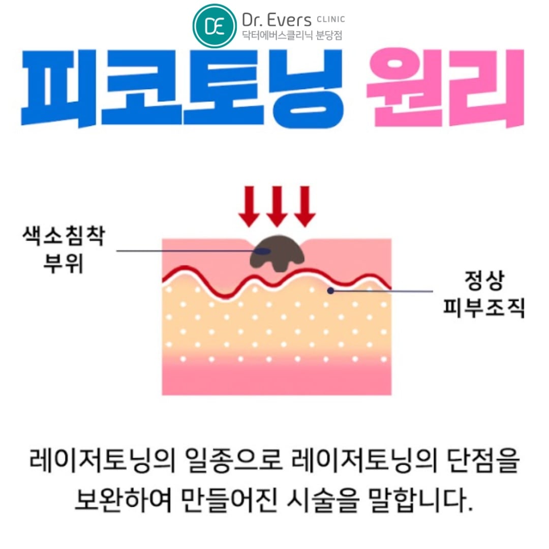 피코토닝 분당피부과 닥터에버스