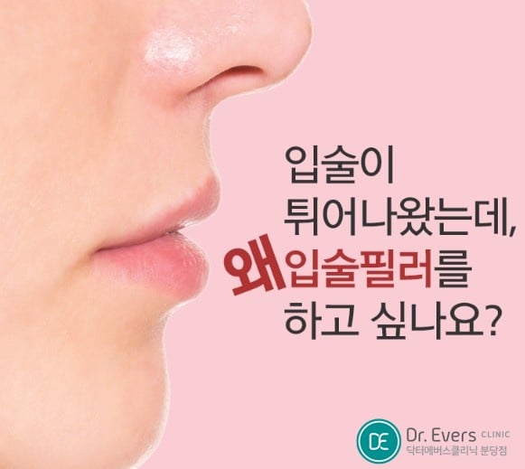 입술 입꼬리 필러 분당피부과 닥터에버스