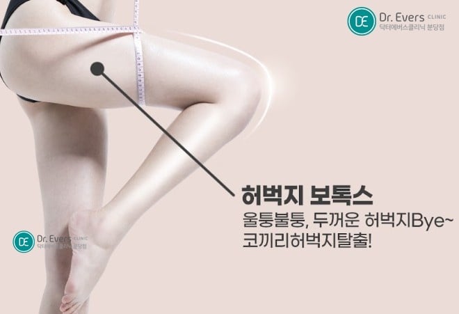 허벅지보톡스 분당피부과 닥터에버스