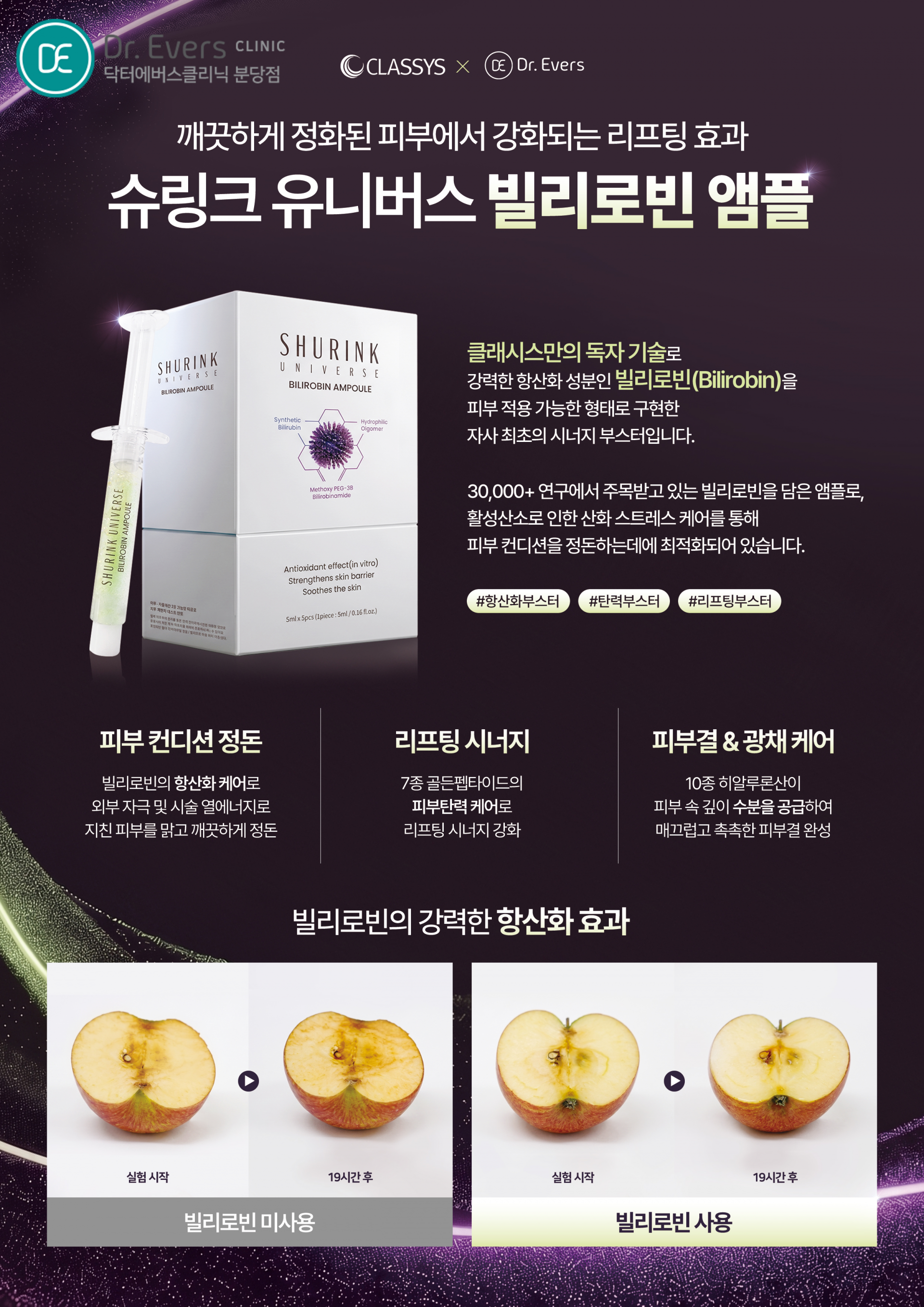 분당 닥터에버스의원_슈링크유니버스 앰플 빌리로빈 효과