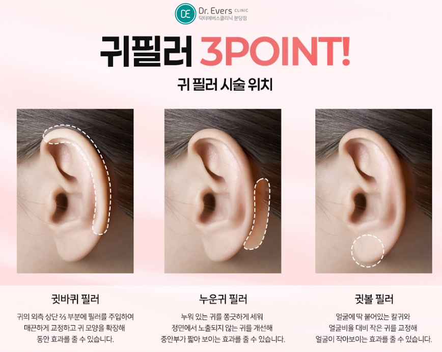 귀필러 분당피부과 닥터에버스