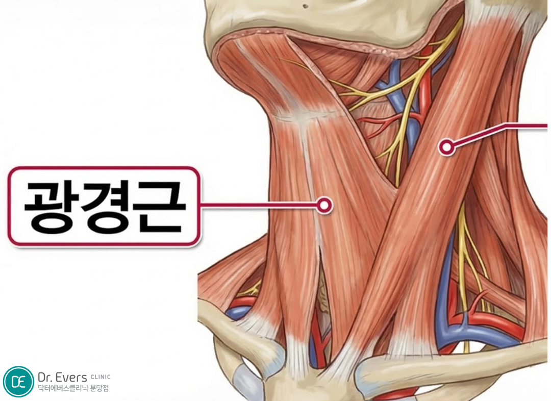 광경근보톡스 분당피부과 닥터에버스